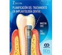Planificación Del Tratamiento En Implantología Dental
