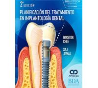Planificación del Tratamiento en Implantología Dental