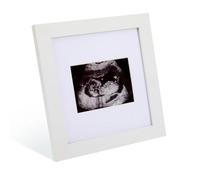 Portarretratos de ecografía de bebé, muestra imágenes de ultrasonido de 3.5 x 2.5 pulgadas, marco de fotos de ultrasonido, letrero de anuncio de embarazo de bebé, decoraciones de revelación de género