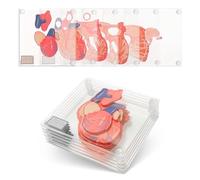 Posavasos anatómicos de espécimen de corazón (Juego de 6) - Juego de Posavasos 3D para Cerebro también Disponible. Regalos de anatomía Humana Regalos de Estudiante de Medicina Regalos para Enfermeras