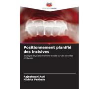 Positionnement planifié des incisives: Stratégie de positionnement fondée sur des données probantes