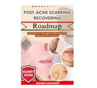 Post-Acne Scarring Recovering Roadmap: Clear Steps For Managing And Reducing The Appearance Of Acne Scars