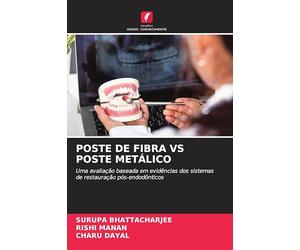 Poste de Fibra Vs Poste Metálico: Uma avaliação baseada em evidências dos sistemas de restauração pós-endodônticos