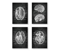 Póster anatómico de neurología cerebral, estructura del cerebro humano, arte médico, anatomía de cabeza, impresiones de neurólogo, psiquiatra, médico, decoración de oficina (SKU9-4 piezas, 12 x 16