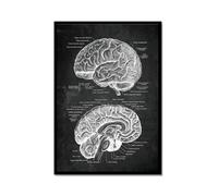 Póster anatómico de neurología cerebral, estructura del cerebro humano, arte médico, anatomía, impresiones de neurólogo, psiquiatra, médico, decoración de oficina (SKU2, 20 x 30 cm, marco de metal