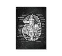 Póster anatómico de neurología cerebral, estructura del cerebro humano, arte médico, anatomía, impresiones de neurólogo, psiquiatra, médico, decoración de oficina (SKU4, 30 x 40 cm, sin marco)