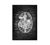 Póster anatómico de neurología cerebral, estructura del cerebro humano, arte médico, anatomía, impresiones de neurólogo, psiquiatra, médico, decoración de oficina (SKU4, 30 x 45 cm, marco de metal