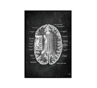 Póster anatómico de neurología cerebral, estructura del cerebro humano, arte médico, anatomía, impresiones de neurólogo, psiquiatra, médico, decoración de oficina (SKU1,30.5 x 45.7 cm= (30 x 45 cm