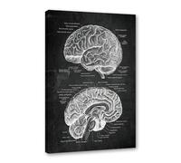 Póster anatómico de neurología cerebral, estructura del cerebro humano, arte médico, anatomía, impresiones de neurólogo, psiquiatra, médico, decoración de oficina (SKU2,40.6 x 50.8 cm, enmarcado
