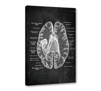 Póster anatómico de neurología cerebral, estructura del cerebro humano, arte médico, anatomía, impresiones de neurólogo, psiquiatra, médico, decoración de oficina (SKU3,12 x 18 pulgadas, enmarcado