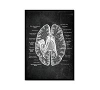 Póster anatómico de neurología cerebral, estructura del cerebro humano, arte médico, anatomía, impresiones de neurólogo, psiquiatra, médico, decoración de oficina (SKU3,12 x 16 pulgadas = (30 x 40 cm