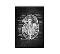 Póster anatómico de neurología cerebral, estructura del cerebro humano, arte médico, anatomía, impresiones de neurólogo, psiquiatra, médico, decoración de oficina (SKU4, 30 x 45 cm), marco de fotos