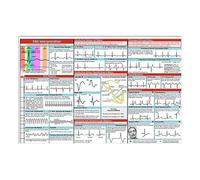 Póster De Interpretación Del Ritmo De ECG: Decoración Ďe Póster Estético Đe Interpretación D́e ECG, Decoración D̄e Arte Dé Pared, Pinturas Ďé Salud Del Corazón, Ďecoración Đé Dormitorio, Herramienta D
