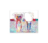 Pósteres Abstractos de Medicina Dental, Pintura de Arte de Pared, Impresiones de Dientes, Regalo de Dentista, Lienzo Impreso, Cuadros de Pared Modernos, decoración de clínica(19,50x70cm No Frame)