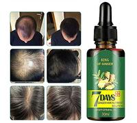 Potenciador avanzado del cabello, crecimiento del cabello, 7 días, jengibre, suero para el crecimiento del cabello germinal, pérdida de aceite de peluquería, 30 ml
