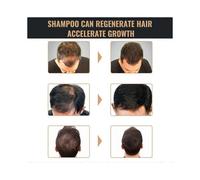 Powerful Hair Care Shampoo Prevent Hair Loss Treatment for Men Repair Shampoo Hair Care