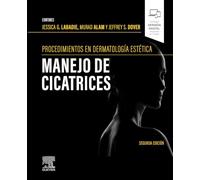 Procedimientos en dermatología cosmética: manejo de cicatrices – Elsevier