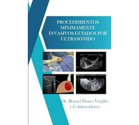 PROCEDIMIENTOS MÍNIMAMENTE INVASIVOS GUIADOS POR ULTRASONIDO