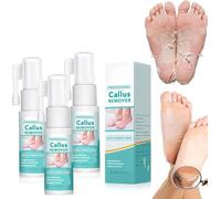 Professional Callus Remover Extra Strength Spray, Foot Callus Remover Extra Strength Spray, for Remove Dead Skin and Calluses on Feet, Instant Foot Peeling Spray Oil (3pcs)