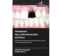 PROGRESSI NELL'IMPLANTOLOGIA ESTETICA: Dalla precisione chirurgica alla perfezione protesica: Concetti moderni di implantologia estetica