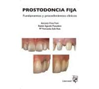 PROSTODONCIA FIJA: FUNDAMENTOS Y PROCEDIMIENTOS CLÍNICOS