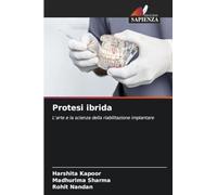 Protesi ibrida: L'arte e la scienza della riabilitazione implantare