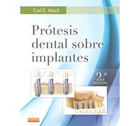 Prótesis dental sobre implantes - 2º Edición