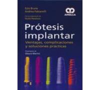 Protesis Implantar: Ventajas Complicaciones Y Soluciones Practicas