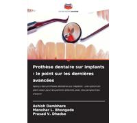 Prothèse dentaire sur implants: le point sur les dernières avancées