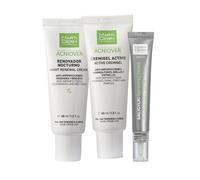 Protocolo Martiderm Acniover para el acné y la piel grasa