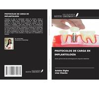 PROTOCOLOS DE CARGA EN IMPLANTOLOGÍA: Visión general de las estrategias de carga de implantes