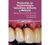Protocolos en Implantología Inmediata Unitaria y Múltiple. Manual Clínico para el día a día