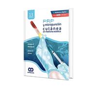 PRP Y MICROPUNCION CUTANEA EN MEDICINA ESTETICA