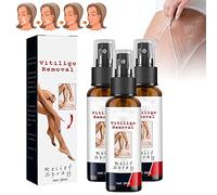 Psoriasis Soothing Spray Vitiligo Care Spray VitiligoRemoval Relief Spray Vitiligo Soothing Spray para equilibrar el tono de la piel y mejorar la piel