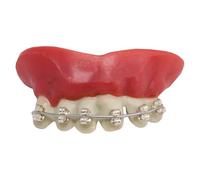 Ptit Clown Dentadura ortodoncia