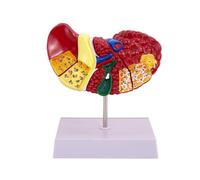 Pyugxab Modelo de anatomía para patologías comunes, modelo de hígado de anatomía , modelo de anatomía médica, oficina