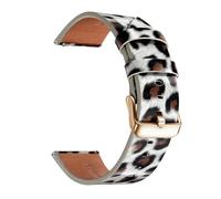 Qgsaghty Correa de reloj de cuero de liberación rápida, correa de reloj de cuero de 20mm y 22mm para mujer, correa de reloj de repuesto, Leopardo 5 Oro Rosa, 20mm