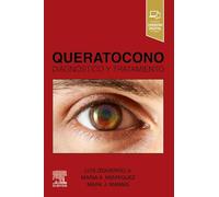 Queratocono: Diagnóstico y tratamiento