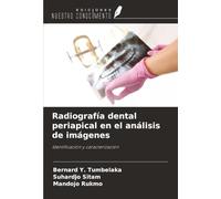Radiografía dental periapical en el análisis de imágenes: Identificación y caracterización