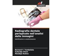 Radiografia dentale periapicale nell'analisi delle immagini: Identificazione e caratterizzazione