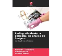 Radiografia dentária periapical na análise de imagens: Identificação e caracterização