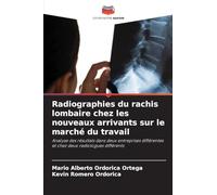 Radiographies du rachis lombaire chez les nouveaux arrivants sur le marché du travail