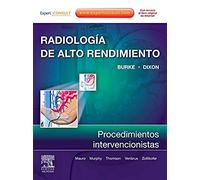 Radiología de Alto Rendimiento: procedimientos intervencionistas