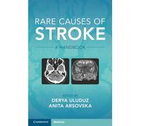 Causas raras del accidente cerebrovascular – Manual