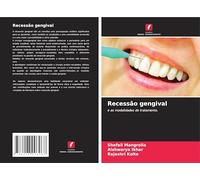 Recessão gengival: e as modalidades de tratamento.