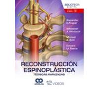 RECONSTRUCCION ESPINOPLASTICA TECNICAS AVANZADAS