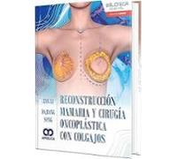 Reconstrucción Mamaria Y Cirugía Oncoplástica Con Colgajos