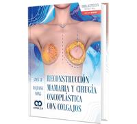 Reconstruccion mamaria y cirugia oncoplastica con colgajos