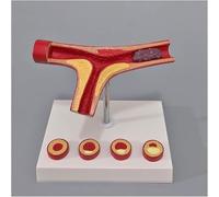 Regalo Médico, Modelo de Arteria Intracraneal, Modelo de Aterosclerosis y Trombosis de la Arteria Humana, Modelo de Arteriosclerosis Cardiovascular, for Estudio de Anatomía