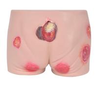 Regalo médico, modelo de enfermería de úlceras por presión avanzada, modelo de cuidado de glúteos de maniquí for personas mayores con úlceras por presión, simulador humano for la enseñanza(PVC)